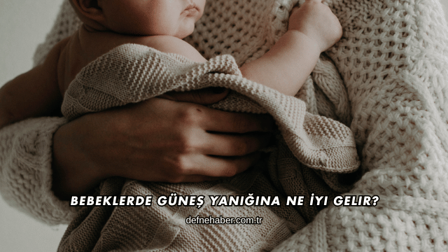 Bebeklerde Güneş Yanığına Ne İyi Gelir?